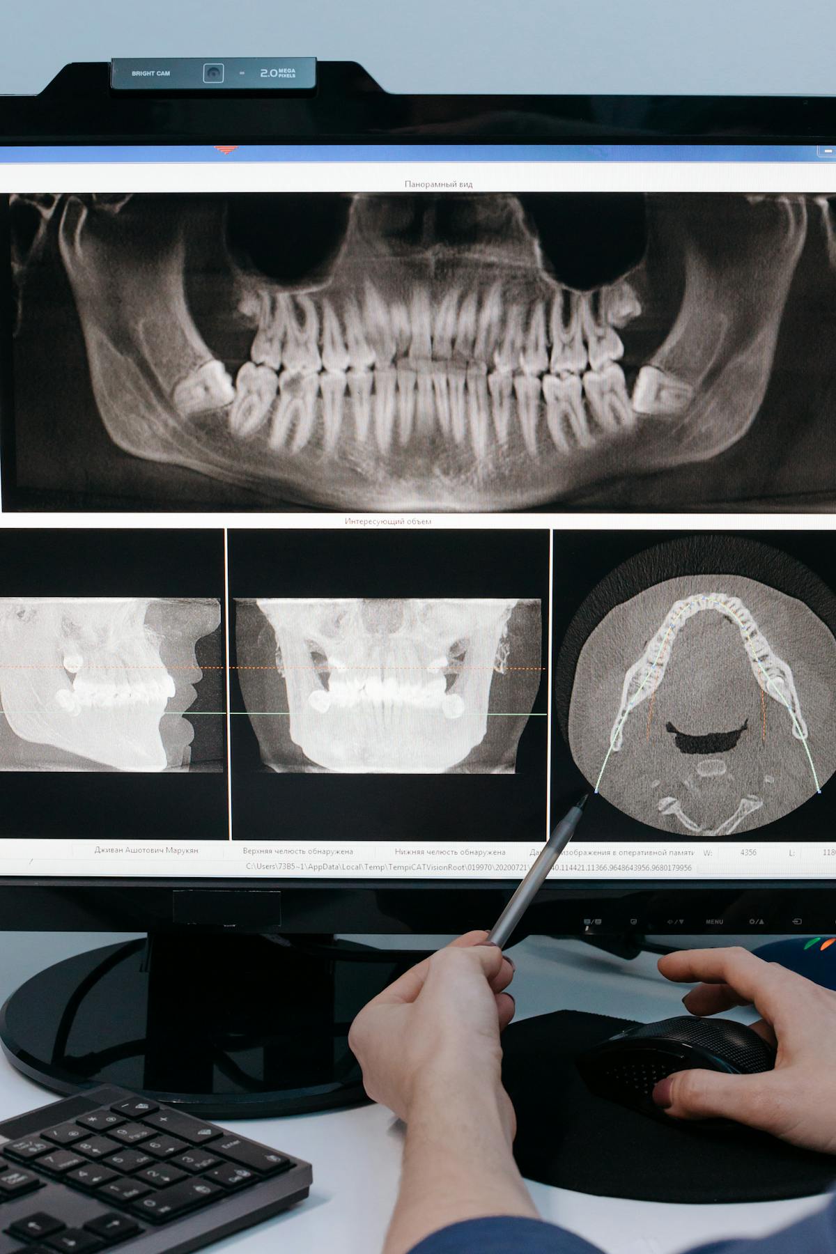 Dental X-ray on screen