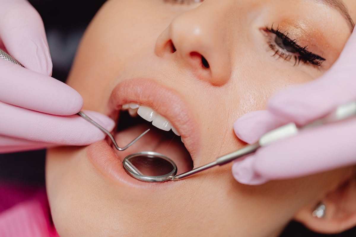 Guide to dental implants